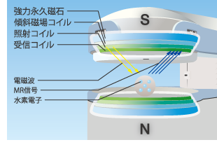 MRIコイル構造